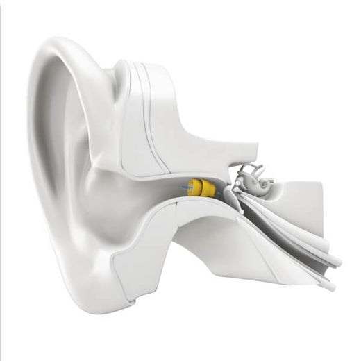 lyric hearing aids invisible